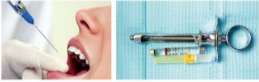 胰島素，牙科麻醉6.png